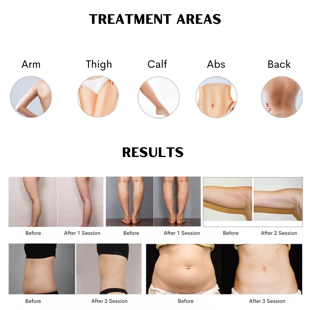 ELORA™ 12D 980nm Diode Lipo Laser
