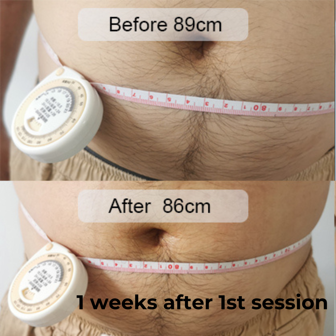 SCULPT-ASSURE 1060nm Diode Laser