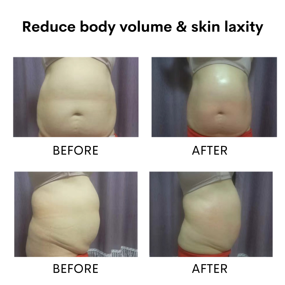 MULTI-NEXIS Body Remodeling 6 in 1