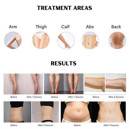 ELORA™ 12D 980nm Diode Lipo Laser